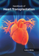 Handbook of Heart Transplantation