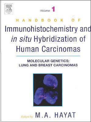 Handbook of Immunohistochemistry and in Situ Hybridization of Human Carcinomas: Molecular Genetics; Lung and Breast Carcinomas - Hayat, M A (Editor)