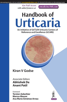 Handbook of Urticaria: An Initiative of GA2LEN Urticaria Centers of Reference and Excellence (UCARE) - Godse, Kiran V, and De, Abhishek, and Patil, Anant
