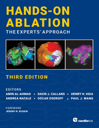 Hands-On Ablation: The Experts' Approach, Third Edition: The Experts' Approach