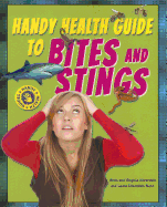 Handy Health Guide to Bites and Stings