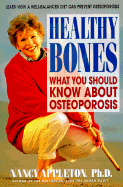 Healthy Bones: What You Should Know about Osteoporosis