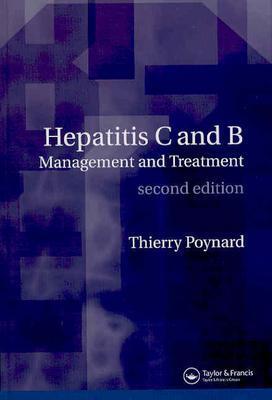 Hepatitis B and C: Management and Treatment - Poynard, Thierry