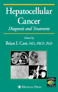 Hepatocellular Cancer: Diagnosis and Treatment