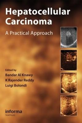 Hepatocellular Carcinoma: A Practical Approach - Al Knawy, Bandar (Editor), and Reddy, K Rajender, MD (Editor), and Bolondi, Luigi (Editor)