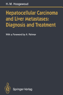 Hepatocellular Carcinoma and Liver Metastases: Diagnosis and Treatment