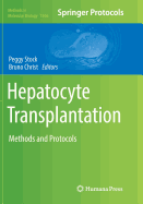 Hepatocyte Transplantation: Methods and Protocols