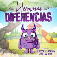 Hermosas Diferencias: Linda Historia Infantil en Espaol sobre Racismo y Diversidad para Ayudar a Ensear a sus Hijos Igualdad y Bondad. (Libros de Cuentos Ilustrados para Nios)