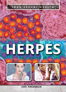 Herpes