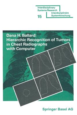 Hierarchic Recognition of Tumors in Chest Radiographs with Computer - Ballard