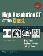 High-resolution CT of the chest comprehensive atlas