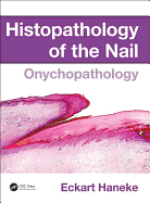 Histopathology of the Nail: Onychopathology