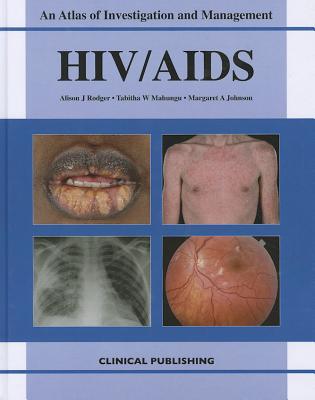 HIV/AIDS - Rodger, A.J. (Editor), and Mahungu, T.W. (Editor), and Johnson, M. A. (Editor)