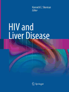 HIV and Liver Disease