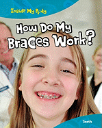 How Do My Braces Work?: Teeth