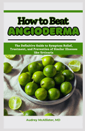 How to Beat Angioderma: The Definitive Guide to Symptom Relief, Treatment, and Prevention of Similar Illnesses like Urticaria