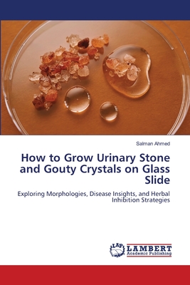 How to Grow Urinary Stone and Gouty Crystals on Glass Slide - Ahmed, Salman