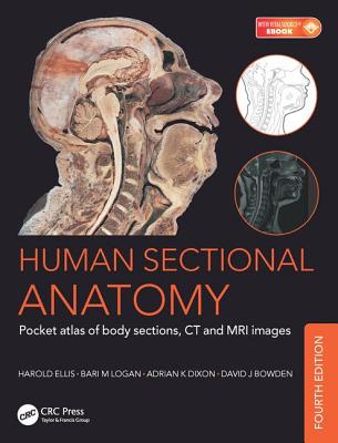 Human Sectional Anatomy: Pocket atlas of body sections, CT and MRI images, Fourth edition - Dixon, Adrian Kendal, and Bowden, David J., and Logan, Bari M.