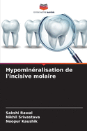 Hypomin?ralisation de l'incisive molaire