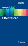 Il Dentascan