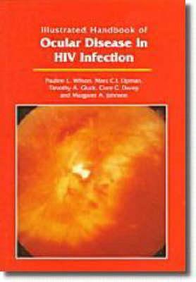 Illustrated Handbook of Ocular Disease in HIV Infection - Davey, Clare C, and Gluck, T a, and Johnson, Margaret A