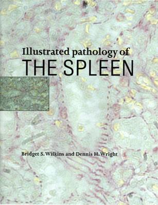 Illustrated Pathology of the Spleen - Wilkins, Bridget S, and Wright, Dennis H