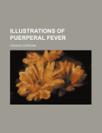 Illustrations of Puerperal Fever