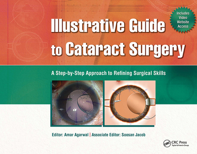 Illustrative Guide to Cataract Surgery: A Step-By-Step Approach to Refining Surgical Skills - Agarwal, Amar, Dr., MS, Frcs