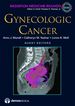 Gynecologic Cancer