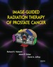 Image-Guided Radiation Therapy of Prostate Cancer
