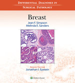 Differential Diagnoses in Surgical Pathology: Breast