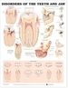 Disorders of the Teeth and Jaw Anatomical Chart