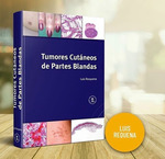 Tumores CutNeos De Partes Blandas