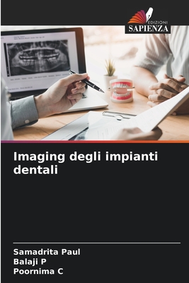Imaging degli impianti dentali - Paul, Samadrita, and P, Balaji, and C, Poornima