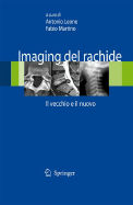 Imaging del Rachide: Il Vecchio E Il Nuovo