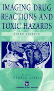 Imaging Drug Reactions and Toxic Hazards