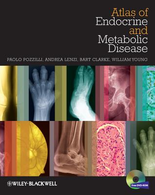 Imaging in Endocrinology - Pozzilli, Paolo, and Lenzi, Andrea, and Clarke, Bart L.