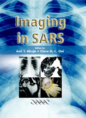 Imaging in Sars - Ahuja, A T (Editor), and Ooi, C G C (Editor)