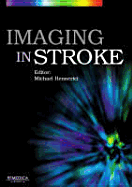 Imaging in Stroke
