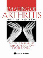 Imaging of Arthritis and Related Conditions