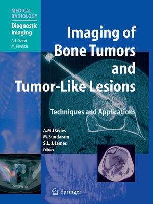Imaging of Bone Tumors and Tumor-Like Lesions: Techniques and Applications - Davies, A Mark (Editor), and Sundaram, Murali (Editor), and James, Steven J (Editor)