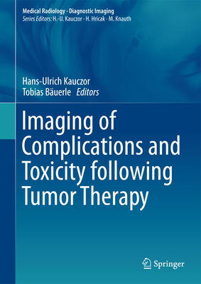 Imaging of Complications and Toxicity following Tumor Therapy - Kauczor, Hans-Ulrich (Editor), and Buerle, Tobias (Editor)