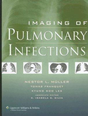 Imaging of Pulmonary Infections - Muller, Nestor L, MD, PhD (Editor), and Franquet, Toms, MD (Editor), and Lee, Kyung Soo, MD (Editor)