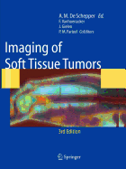 Imaging of Soft Tissue Tumors