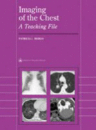 Imaging of the Chest: A Teaching File - Mergo, Patricia J, MD (Editor)