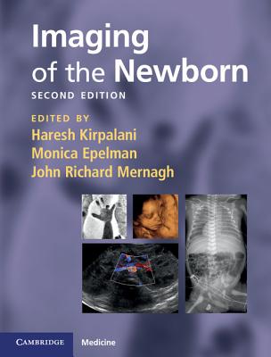 Imaging of the Newborn - Kirpalani, Haresh (Editor), and Epelman, Monica (Editor), and Mernagh, John Richard (Editor)