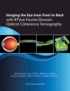 Imaging the Eye from Front to Back with RTVue Fourier-Domain Optical Coherence Tomogaphy