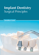 Implant Dentistry: Surgical Principles