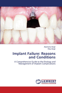 Implant Failure: Reasons and Conditions