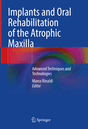 Implants and Oral Rehabilitation of the Atrophic Maxilla: Advanced Techniques and Technologies